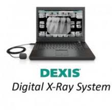 Dexis Digital X-ray